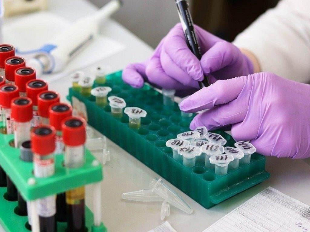 Polmoniti Covid: anakinra e metilprednisolone dimezzano mortalità