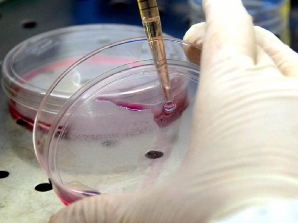 Una molecola estratta dalla lattuga selvatica, una pianta molto comune e non commestibile, potrebbe potenziare le terapie antitumorali contro il glioblastoma