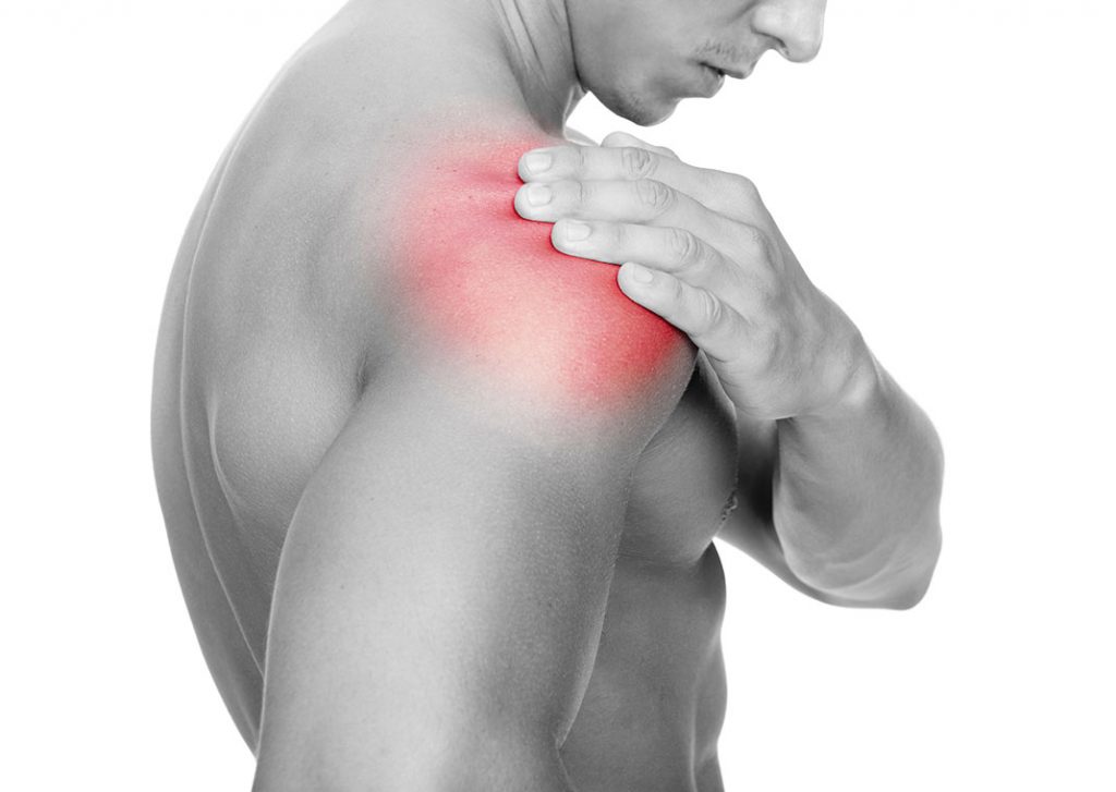 Sindrome da impingement: le cause più comuni delle infiammazioni alla spalla