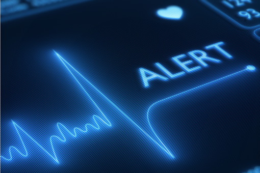 Nei pazienti sottoposti ad ablazione con catetere per la fibrillazione atriale un breve ciclo di colchicina non riduce le recidive di aritmia atriale