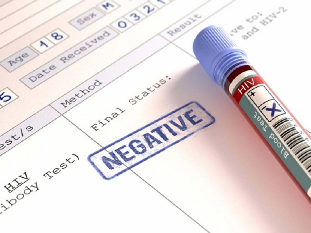 I risultati di un test per Hiv e una fiala di sangue