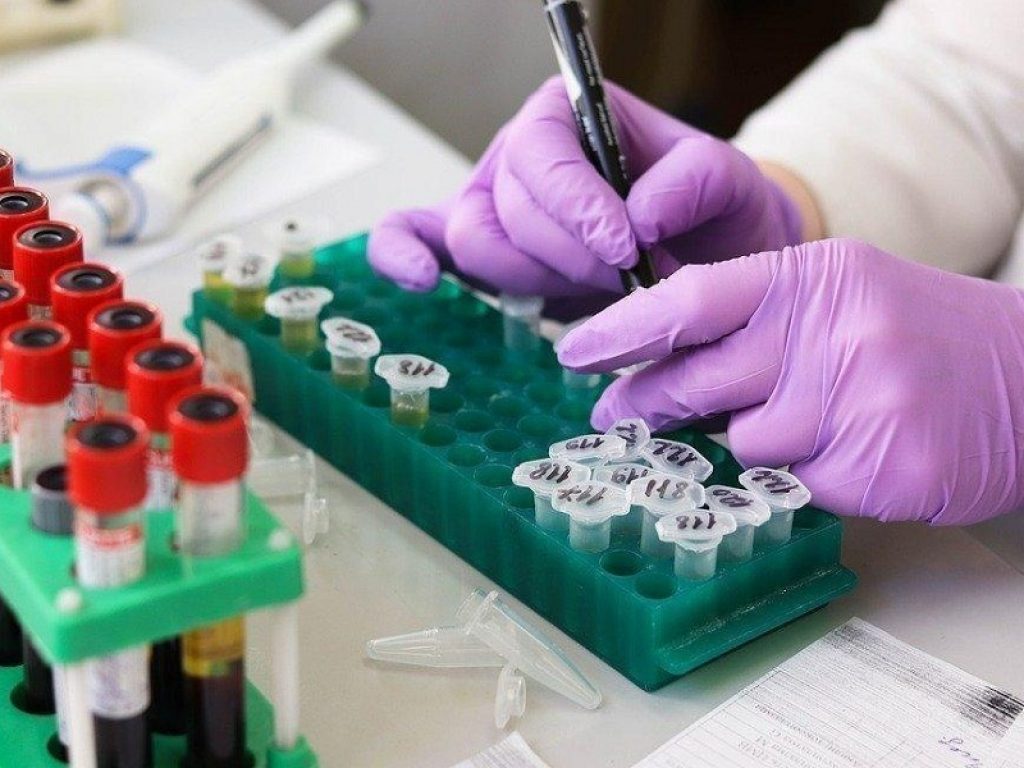 Mieloma multiplo: le Car-T sono una nuova arma molto efficace. Il 73% dei pazienti pesantemente pretrattati risponde alla terapia cellulare