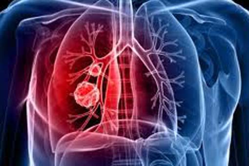 Fibrosi cistica immunoterapia