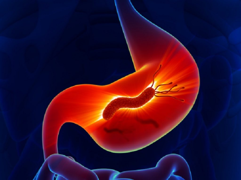 Helicobacter pylori