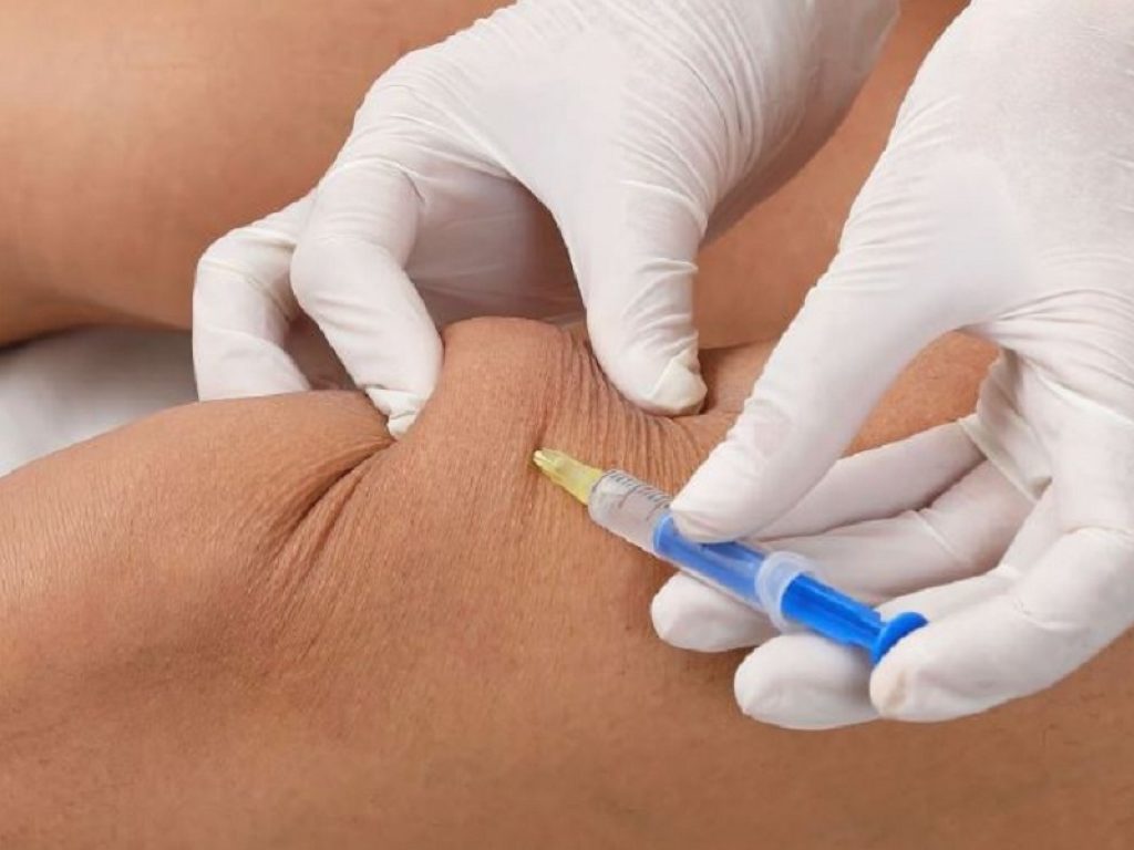 Mesoterapia, medicina