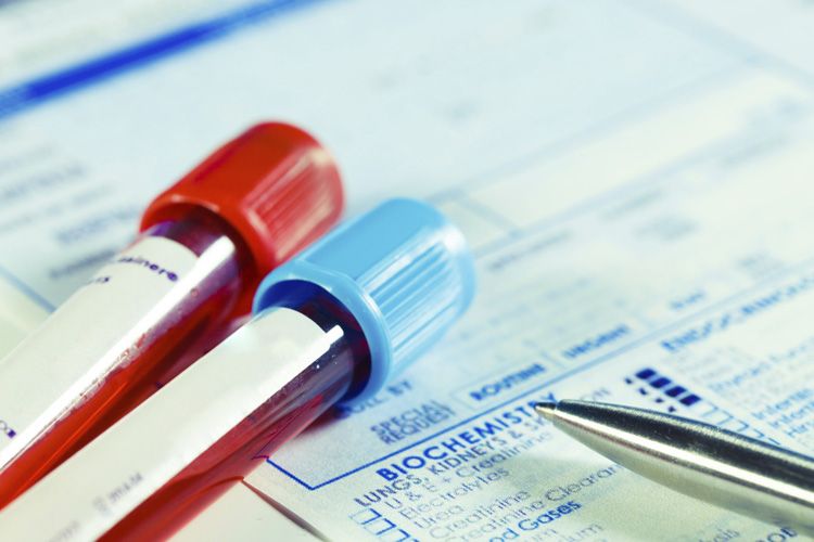 linfoma follicolare car-t axi-cel