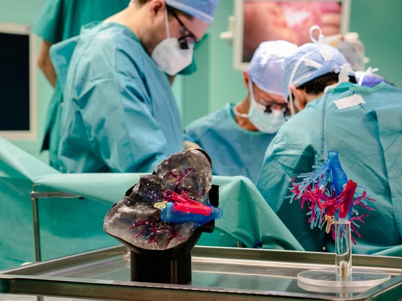 ipertensione portale malattia linfoproliferativa