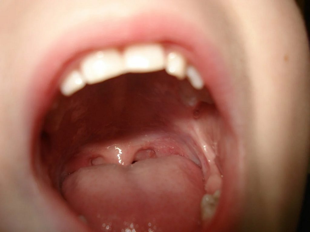 denti bocca cavo orale