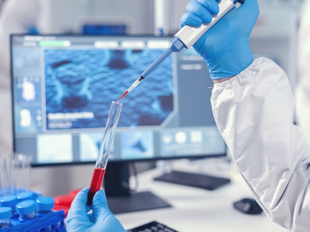 Piombo Un prelievo di sangue è sufficiente per diagnosticare, classificare e tenere sotto controllo il sarcoma di Ewing, un tumore infantile che colpisce le ossa