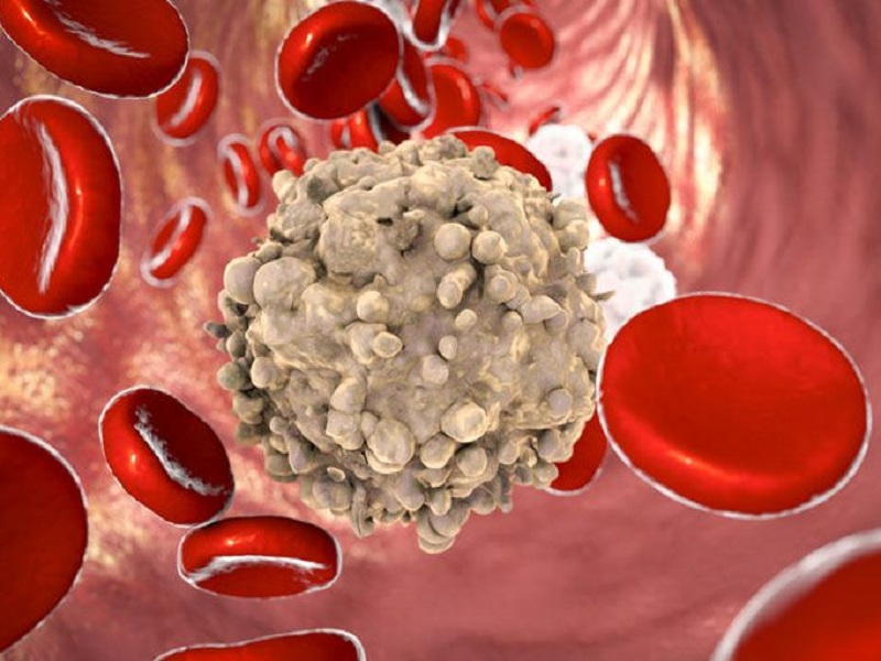 leucemia mieloide decitabina ivosidenib