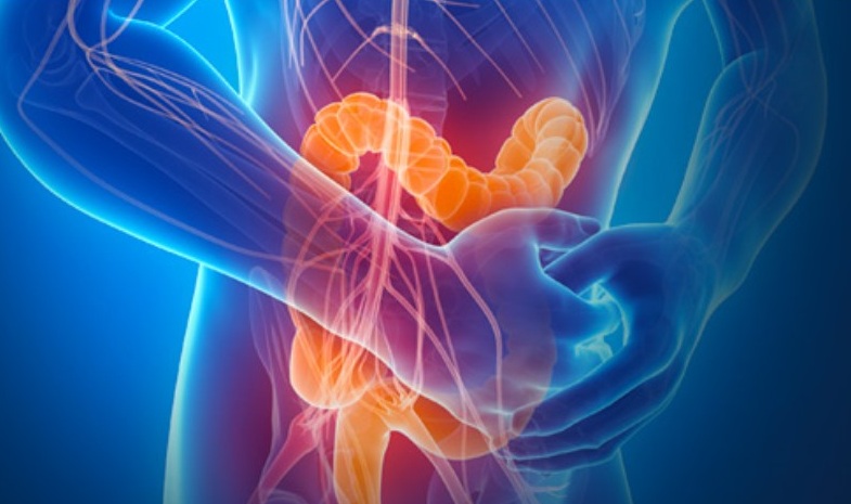 Nei pazienti con malattia infiammatoria cronica intestinale è stata identificata una triplice interazione tra HLA-B27, sesso maschile e sviluppo di sacroileite