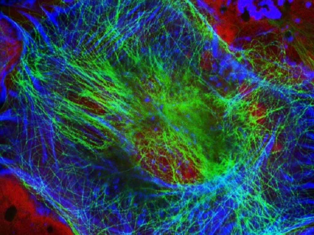 Neuroblastoma: nucleolina al centro della ricerca