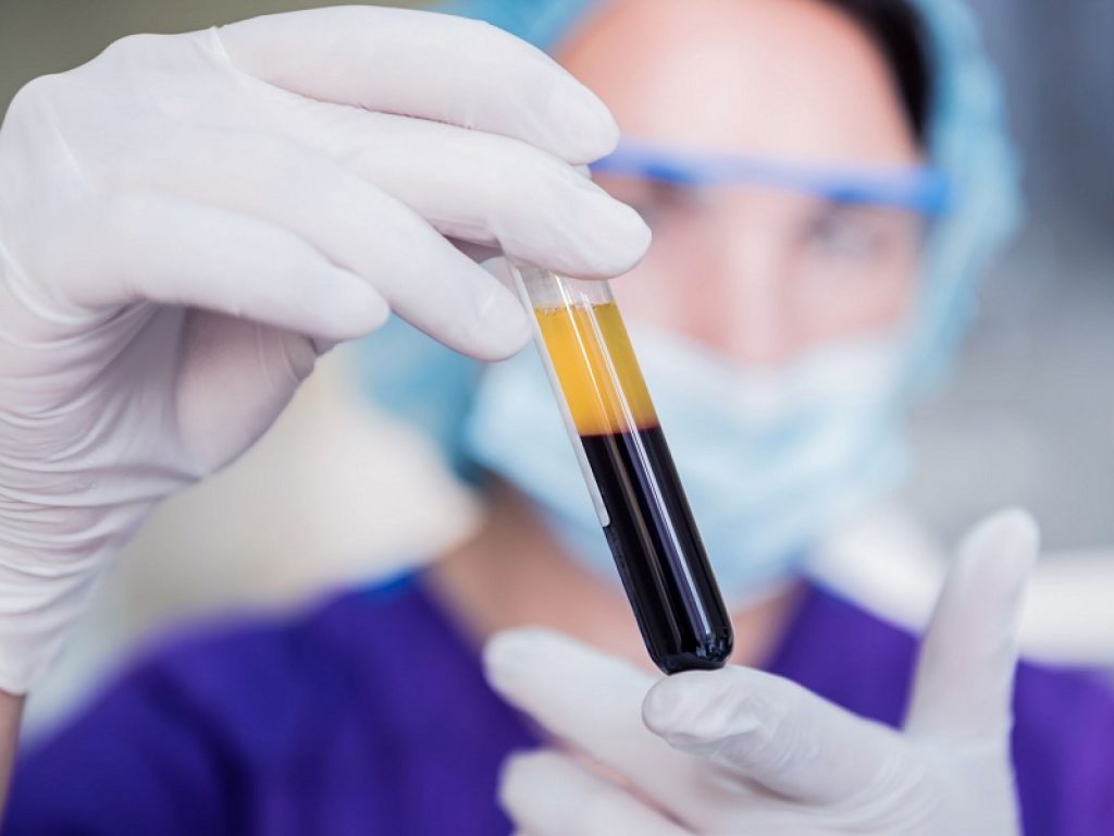 La fibrina ricoprirebbe un ruolo strategico nella stabilizzazione del coagulo di sangue originale e nell’impedire il distacco dei frammenti