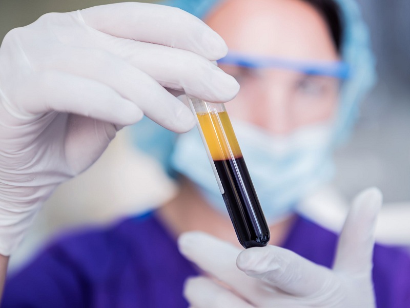 La fibrina ricoprirebbe un ruolo strategico nella stabilizzazione del coagulo di sangue originale e nell’impedire il distacco dei frammenti