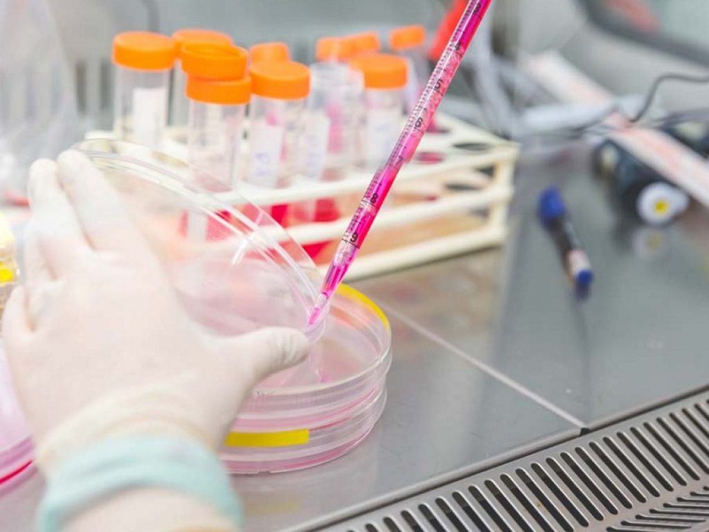 ricerca distrofie muscolari