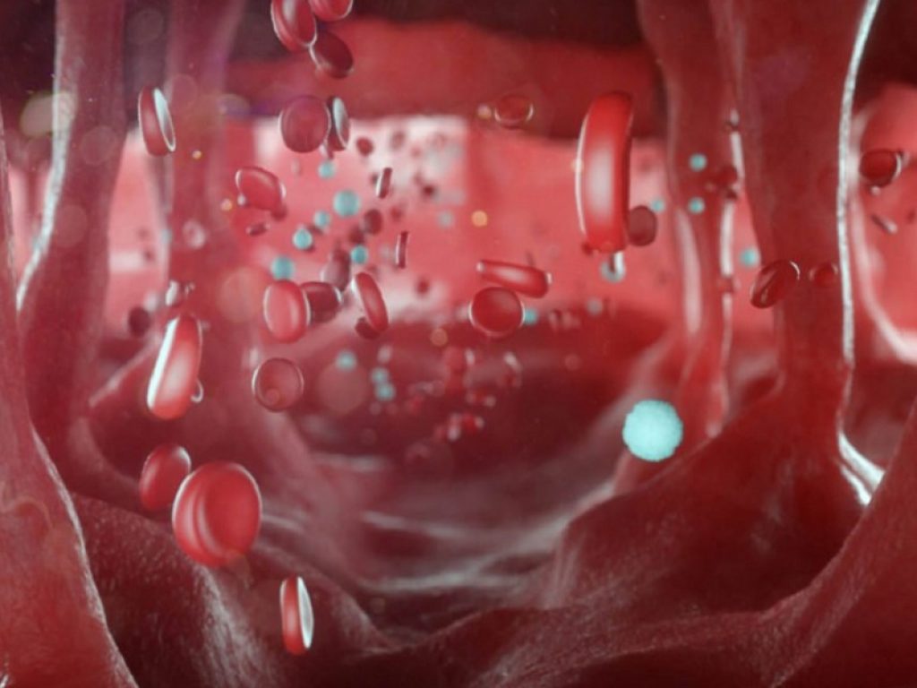 sutimlimab sangue anemia falciforme roxadustat