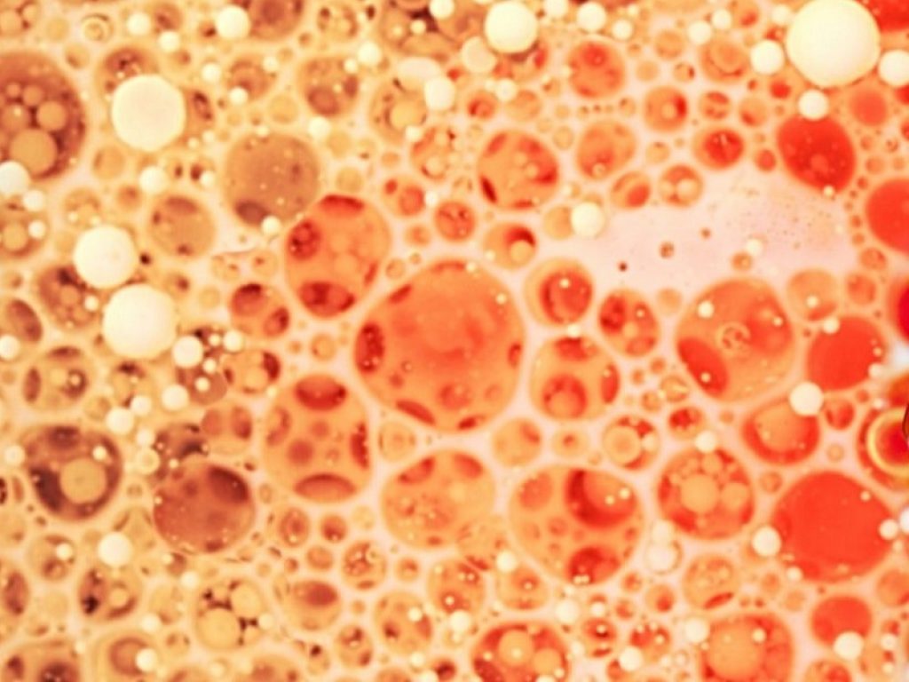 teleangiectasia emorragica ereditaria