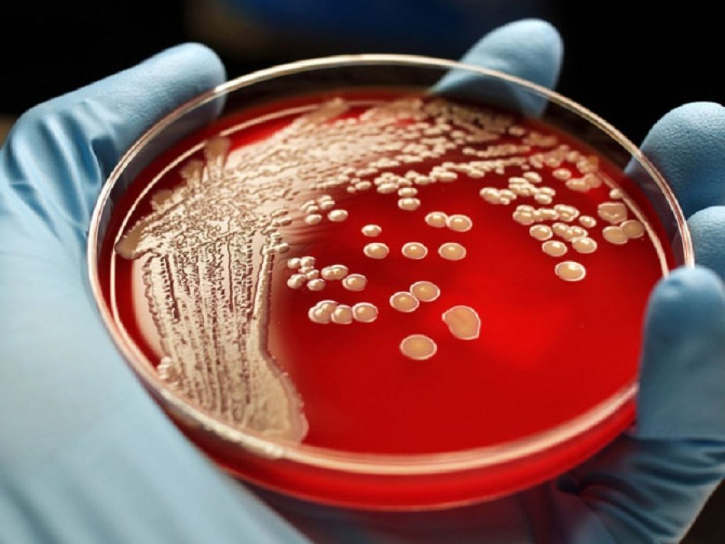 Un probiotico a base di Bacillus subtilis ha ridotto in modo sicuro la colonizzazione da Staphylococcus aureus senza danneggiare il microbiota intestinale