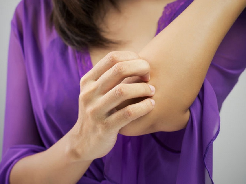 ebglyss Idrogel Dermatite atopica, tapinarof andea