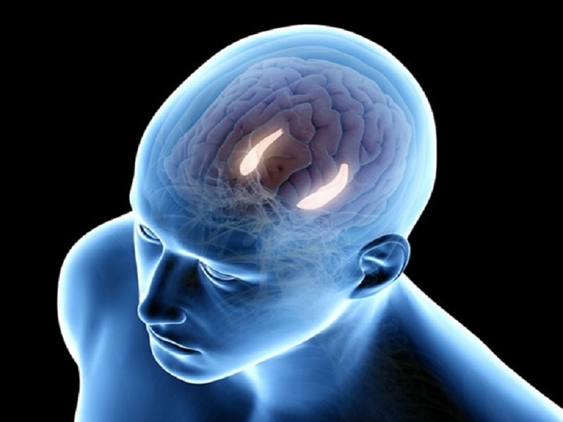 ippocampo alzheimer lecanemab