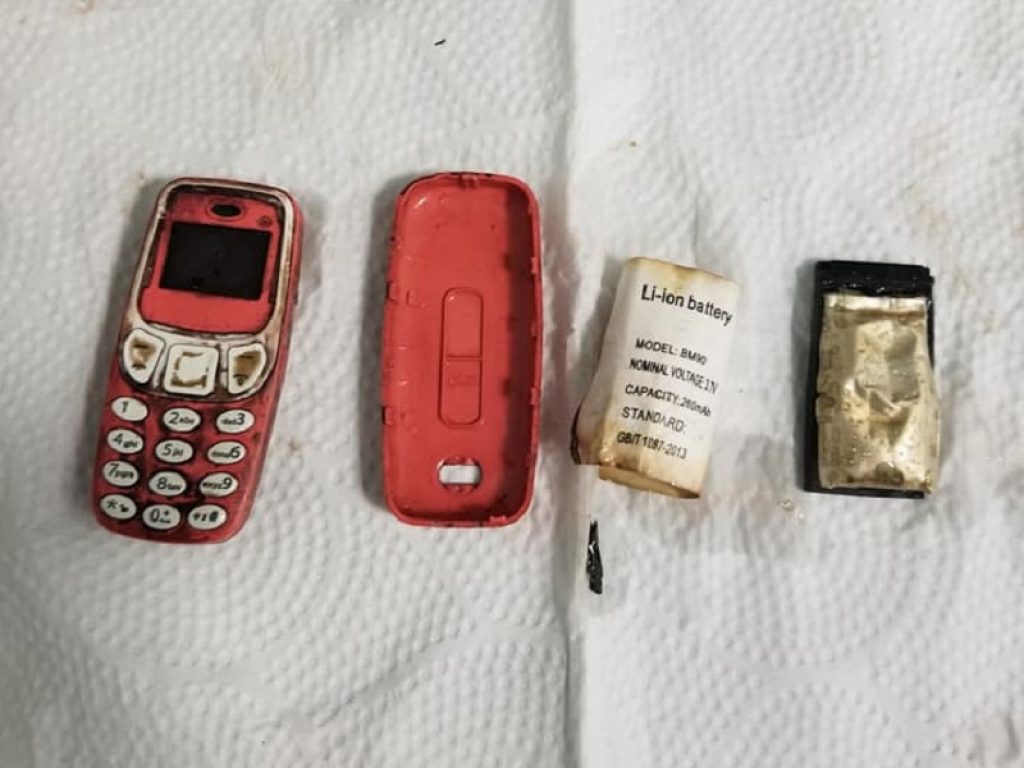 Incredibile storia dal Kosovo: un 33enne ha ingoiato un Nokia 3310 e dopo 4 giorni di dolori lancinanti è stato ricoverato e operato