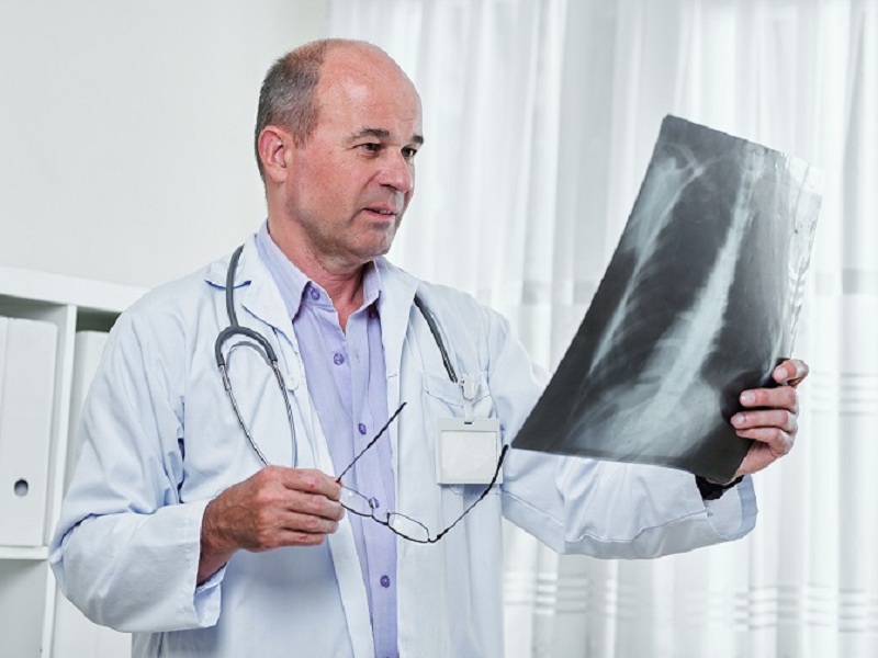 nintedanib sottogruppi sildenafil aspergillosi virus respiratorio sinciziale international respiratory coalition