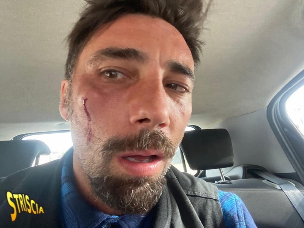 Vittorio Brumotti colpito da un pugno mentre girava a Foggia un servizio per "Striscia la notizia" sullo spaccio di droga: arrestati i due aggressori