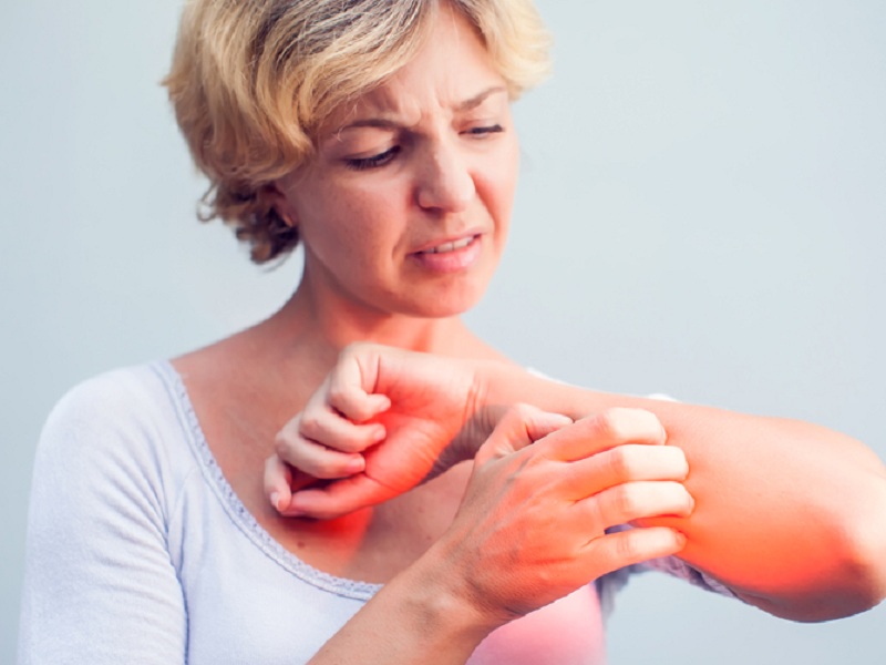 Nei pazienti con prurigo nodularis e dermatite atopica, l'anticorpo monoclonale sperimentale nemolizumab ogni 4 settimane si è dimostrato efficace