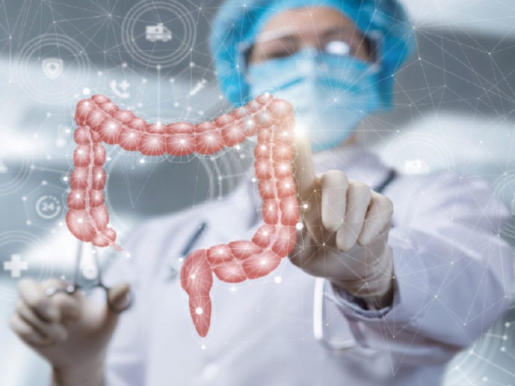 Malattia infiammatoria intestinale in mantenimento con anti-TNF, basso rischio di perdita di risposta sospendendo l'immunomodulatore