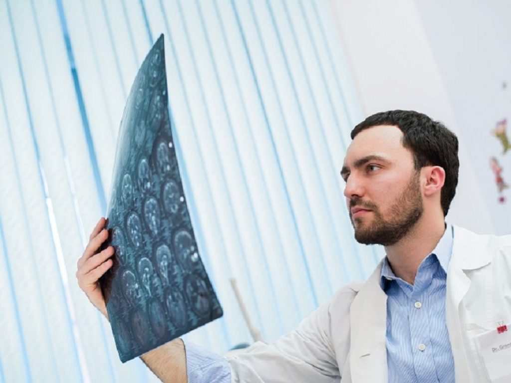 frexalimab cladibrina ozanimod natalizumab volume cerebrale sclerosi multipla restrizione calorica cladribina