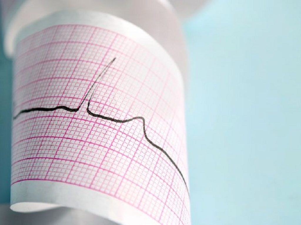 Telecardiologia: prime linee guida per diagnosi sicure