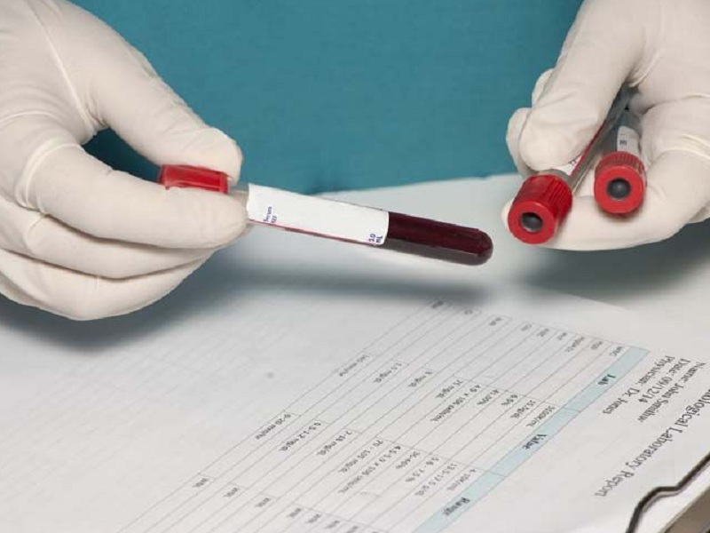 Mieloma multiplo recidivato o refrattario: Janssen richiede all'Agenzia europea del farmaco l'autorizzazione per l'anticorpo bispecifico teclistamab