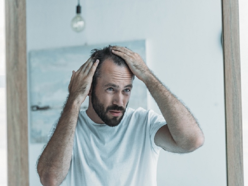 alopecia areata brepocitinib