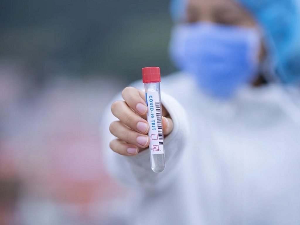 Il farmacologo Francesco Scaglione del Niguarda di Milano: “Necessari studi su vaccino pan-coronavirus contro nuove varianti”