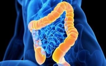 IICB e intestino corto: al via nuovo progetto di assistenza