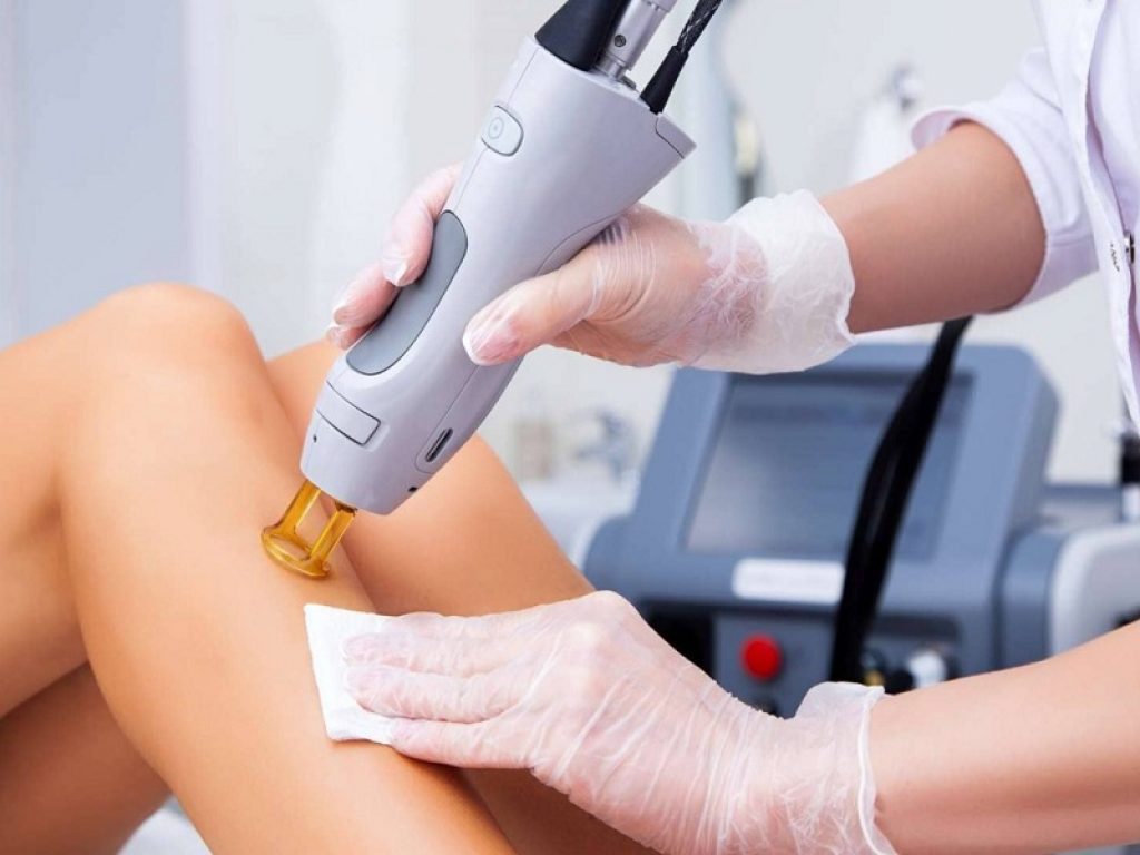 Depilazione laser: quando è il momento giusto per farla