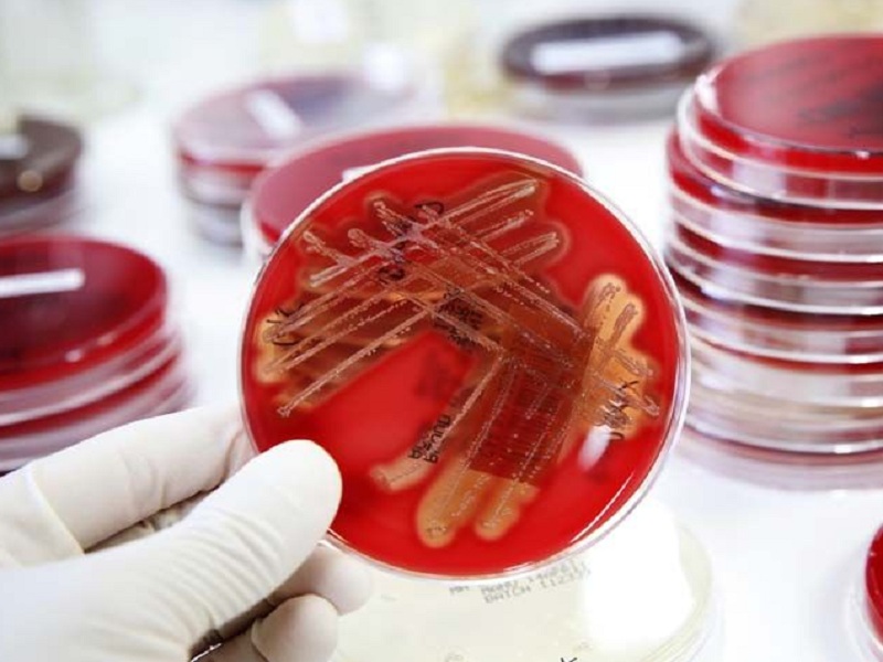 Infezioni da batteri multiresistenti: al Congresso Nazionale SIMIT di Milano focus su come evitare una nuova pandemia