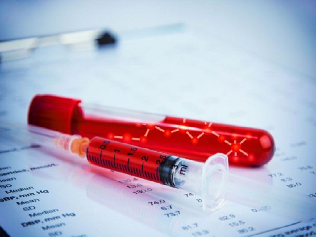 Tumori del sangue: migliorano le opportunità di cura grazie ai nuovi farmaci, ma non vi è uniformità di accesso ai più elevati standard di assistenza