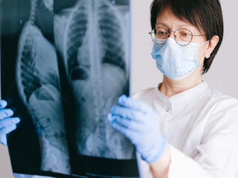 Polmoniti comunitarie: secondo lo studio ACCESS, claritromicina in aggiunta ad antibiotici beta-lattamici migliora la risposta clinica