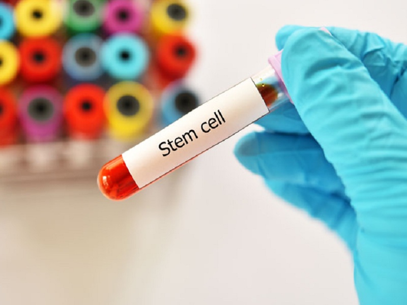 embrioni umani sintetici trapianto di cellule staminali autologhe