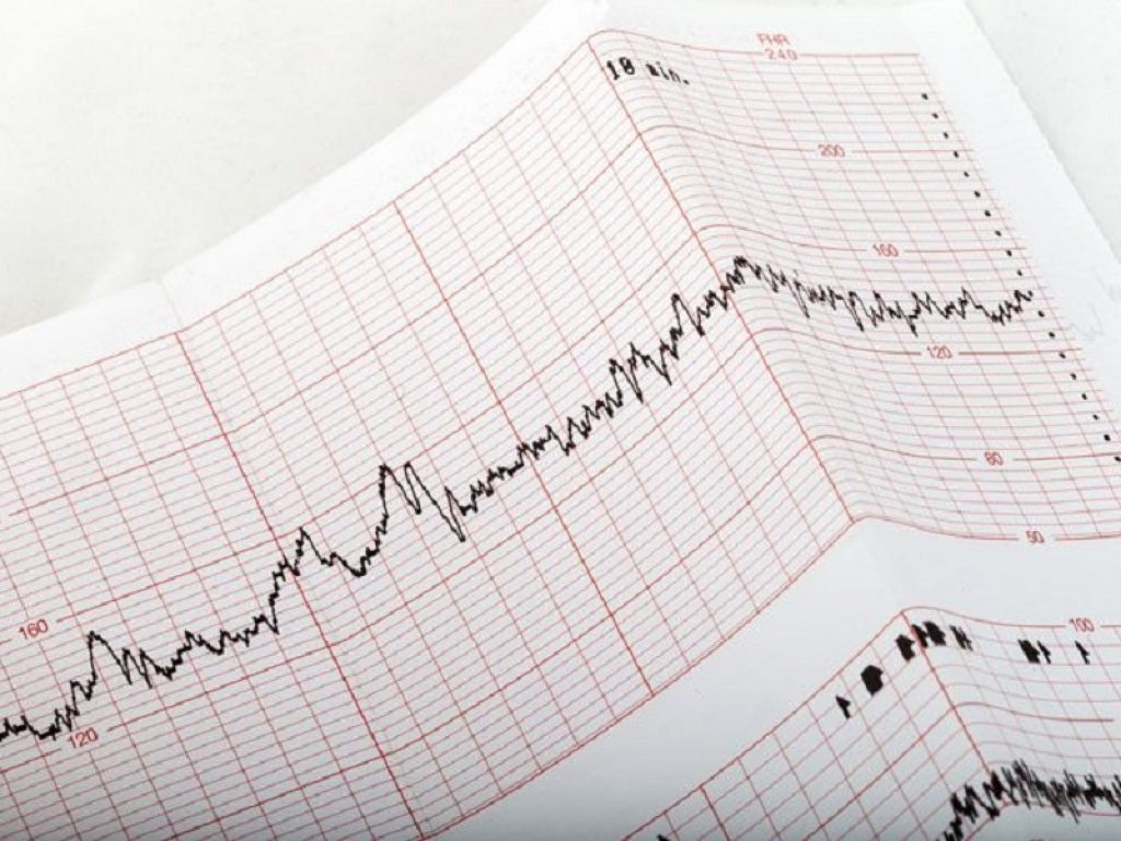 noac sacubitril screening cardiovascolare