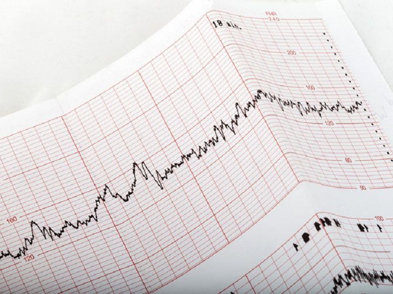 noac sacubitril screening cardiovascolare