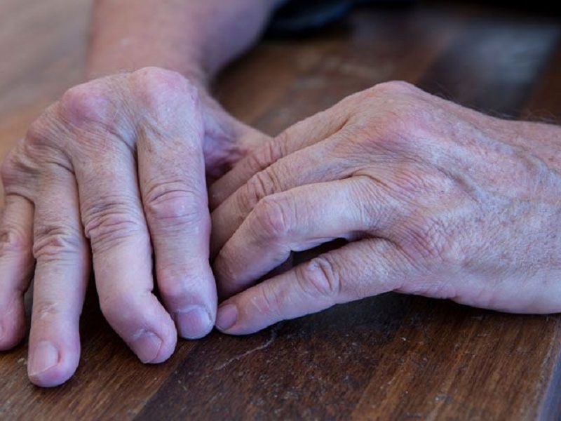 artrite psoriasica deucravacitinib