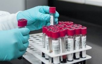 riluzolo sclerosi multipla sangue re-evolution