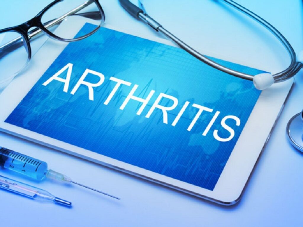 artrite idiopatica giovanile