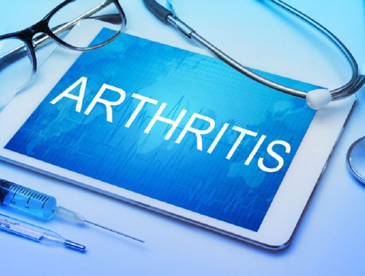 artrite idiopatica giovanile