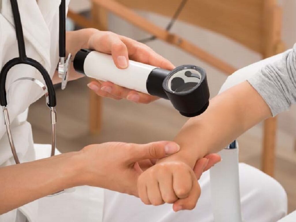 epidermolisi bollosa