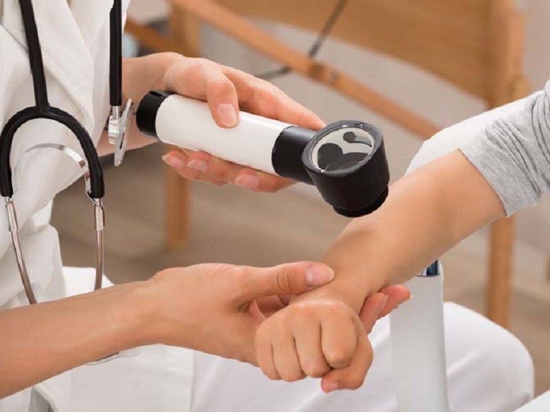 epidermolisi bollosa