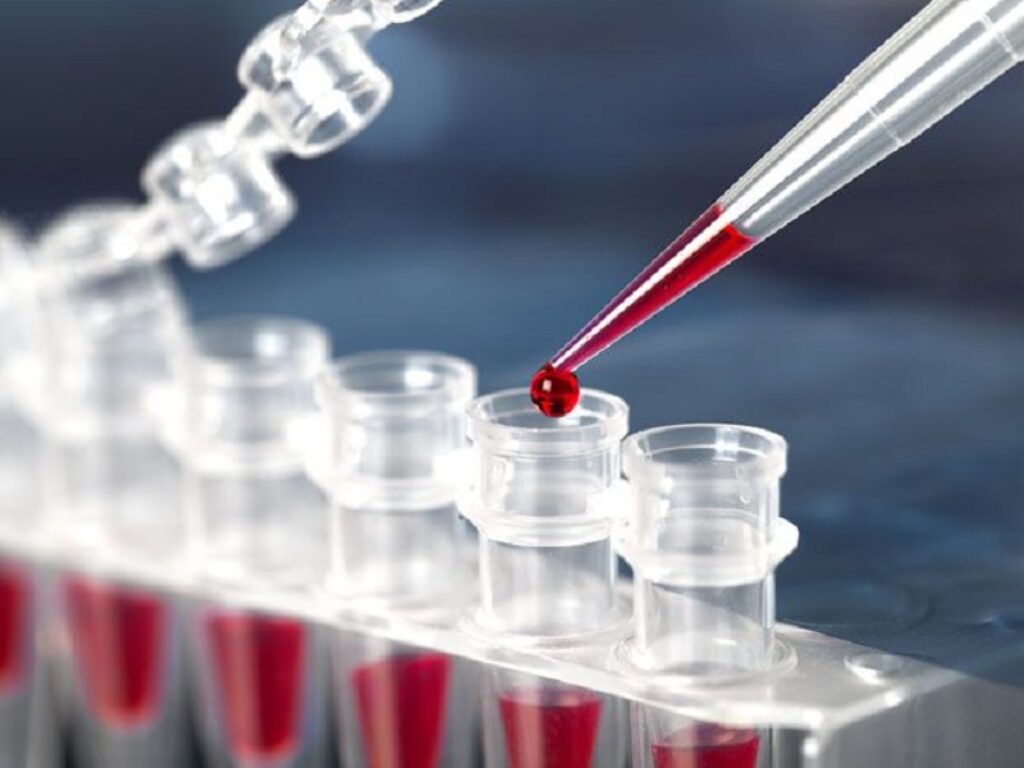 tafasitamab linfoma gemcitabina