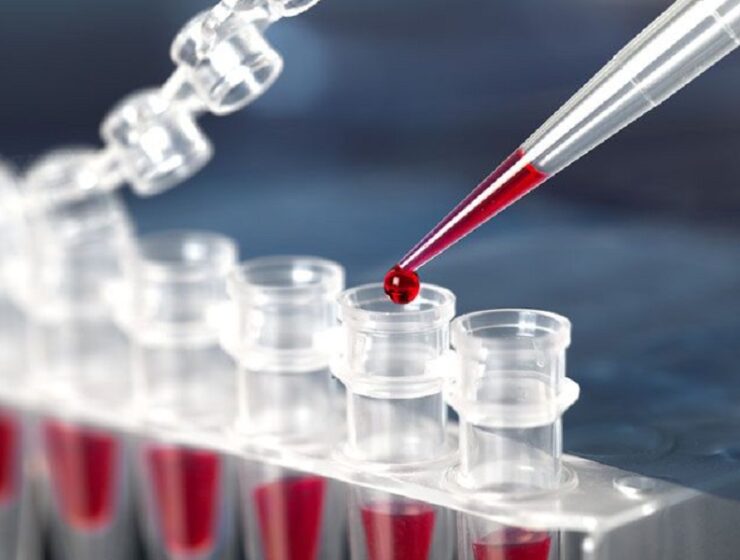 tafasitamab linfoma gemcitabina